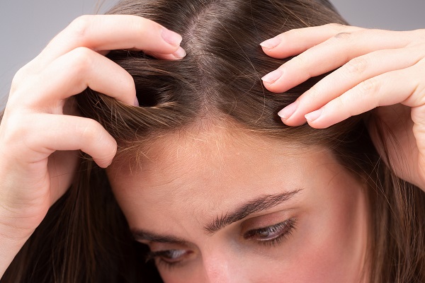 Hairstyles Can Help You Hide Your Frontal Fibrosing Alopecia