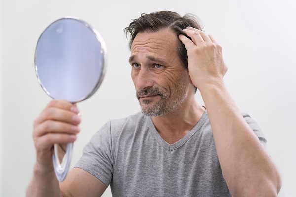 Causes of Hair Loss in Men