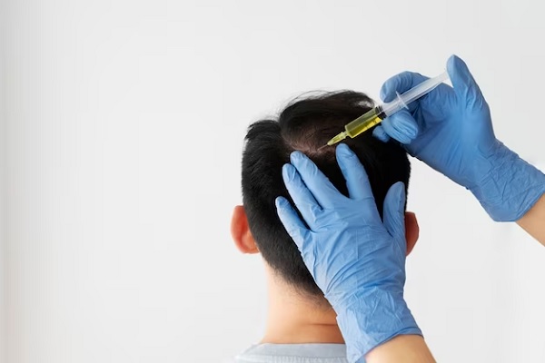 hair mesotherapy