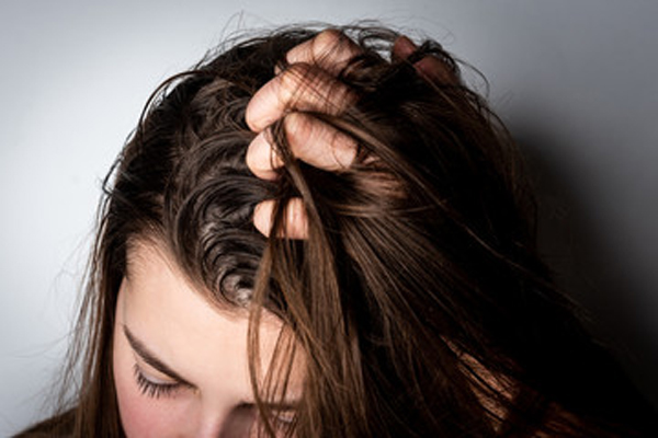 oily scalp What causes baldness 