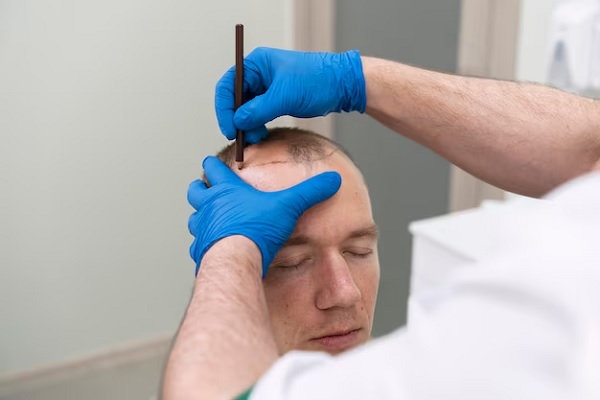 The Process of Hair Donation
