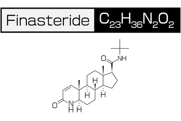 Finasteride for hair transplant at 50
