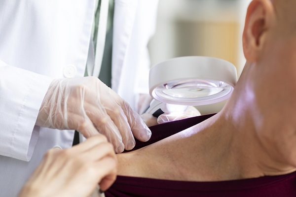 Causes, Symptoms, Treatment, and Impact of Psoriasis on Capillary