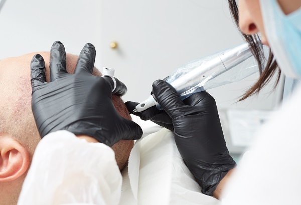 Image of Tricopigmentation: What It Is & How It Enhances Results