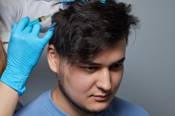 Alopecia in Young People