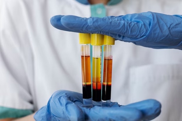 hands with medical gloves hold vials with blood tests