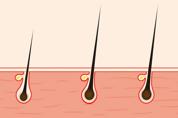 follicles growing from the scalp