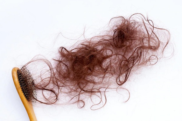 Hair Loss Caused by Covid