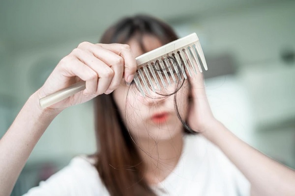 Androgenetic Alopecia