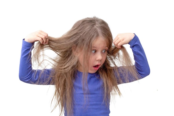 alopecia in children