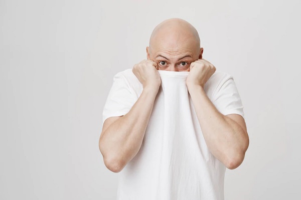 Baldness, How Does It Affect Psychologically?