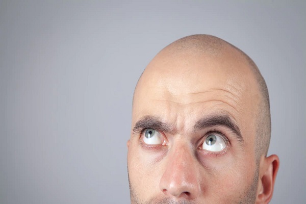 How Can Shock Loss Be Prevented After Getting a Hair Transplant?