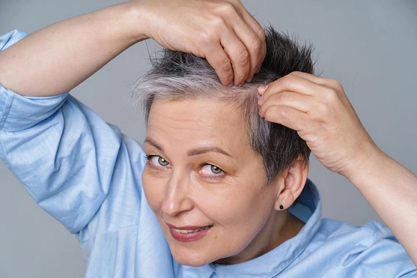 Alopecia In Menopause