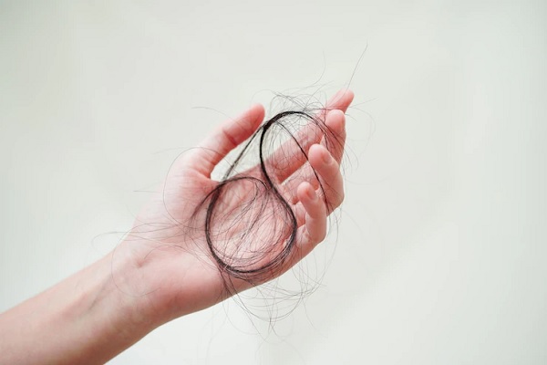 Alopecia In Menopause
