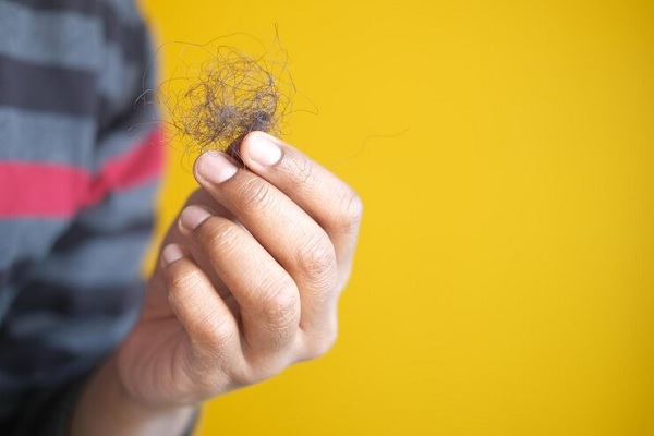 shedding effect