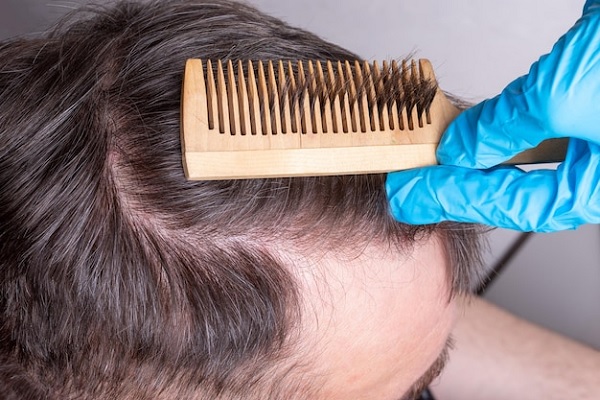 shedding effect