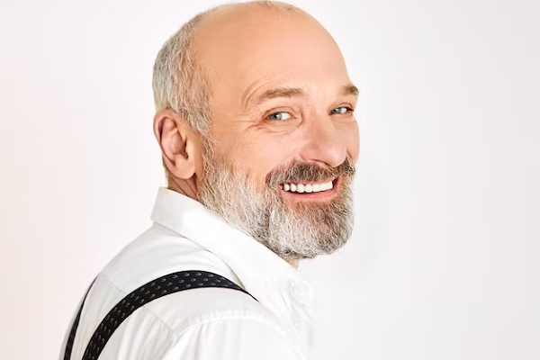 man smiling before hair transplant at 50