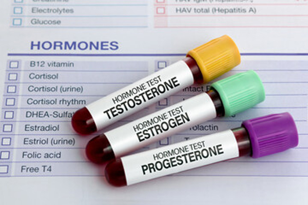 sex hormones test
