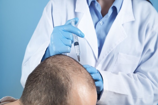 a doctor performing a hair transplant surgery on a patient