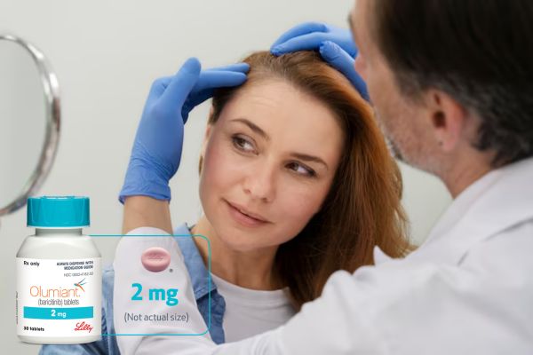 Olumiant for Alopecia Areata
