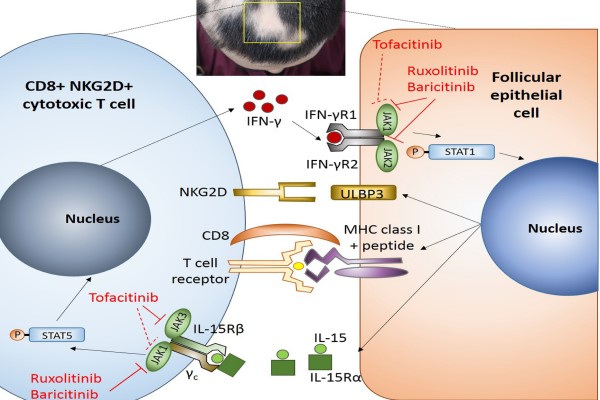 jak inhibitors