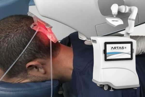 artas modern techniques hair transplantation evolution - hair transplant for men
