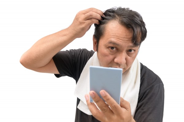 Greasy Hair and Alopecia