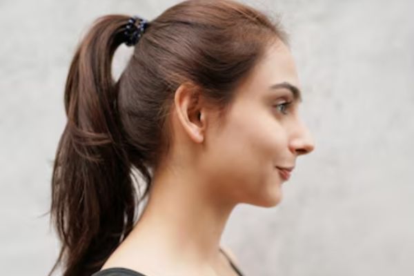 woman with traction alopecia because of damaged hair follicles