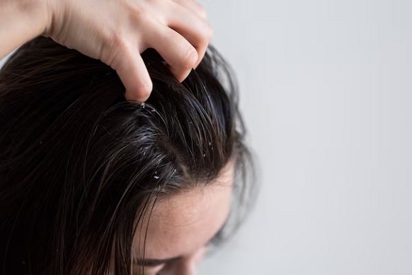What Are The Best Treatments For Oily Hair