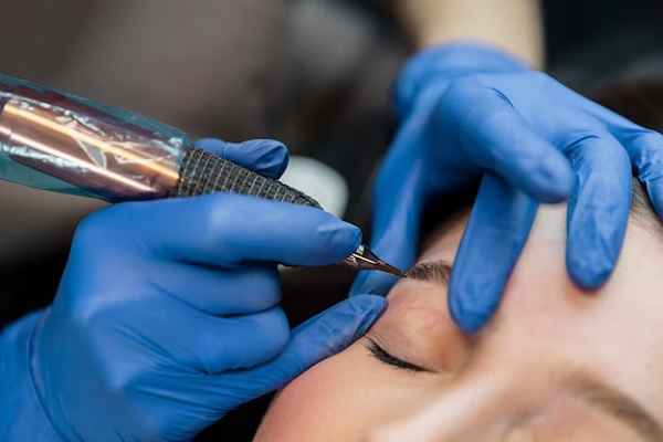 close-up shot of a woman at the esthetician, who is performing a capillary microimplementation on her.