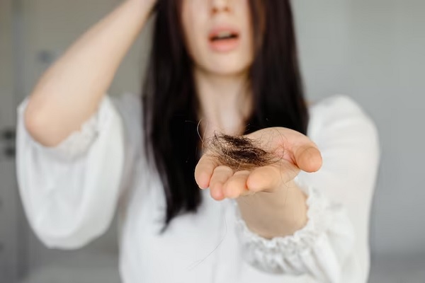 a woman showing how she loss hair